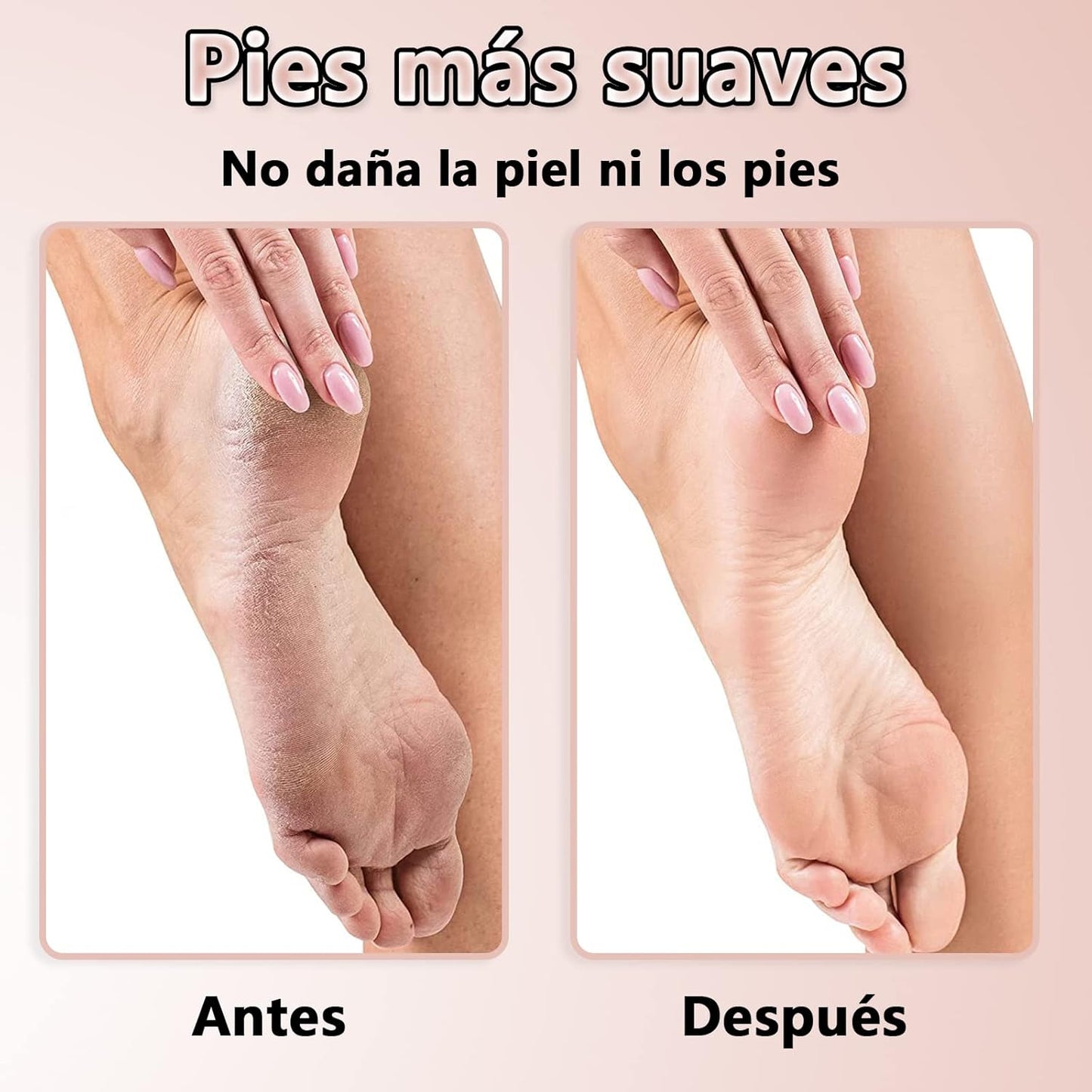 Removedor Eléctrico de Grietas y Callos para los Pies