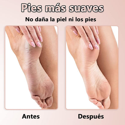 Removedor Eléctrico de Grietas y Callos para los Pies